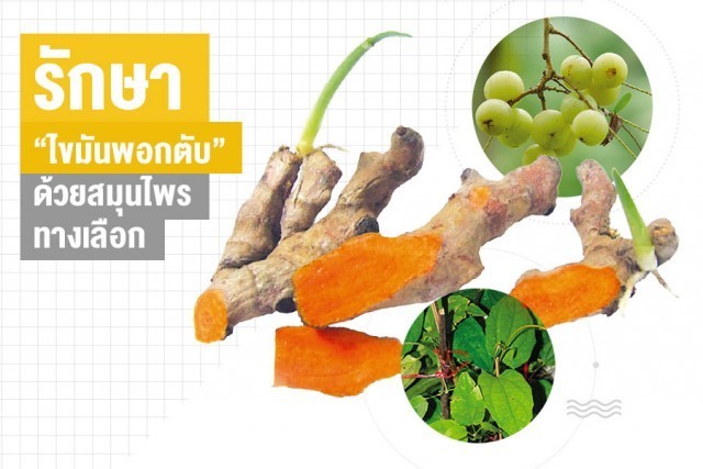 รักษา “ไขมันพอกตับ” ด้วยสมุนไพรทางเลือก
