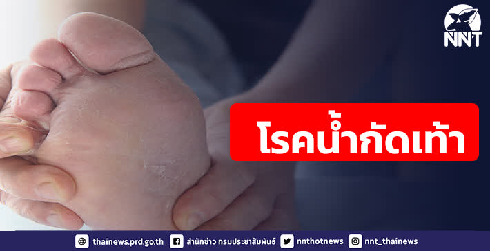 แนะนำ วิธีการดูแลผู้ป่วยโรคน้ำกัดเท้า ในพื้นที่น้ำท่วมอย่างถูกวิธี