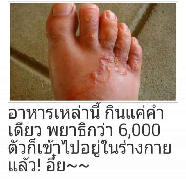 ดูไว้เลย! อาหารเหล่านี้ กินคำเดียว พยาธิกว่า 6,000 ตัว เข้าไปอยู่ในร่างกายคุณแน่นอน!