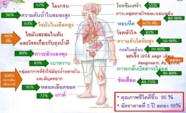 ทางเลือกการสกัดโรคอ้วน