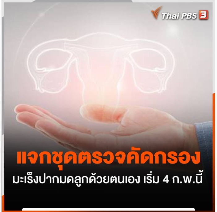 แจกชุดตรวจคัดกรอง มะเร็งปากมดลูกด้วยตนเอง เริ่ม 4 ก.พ.นี้