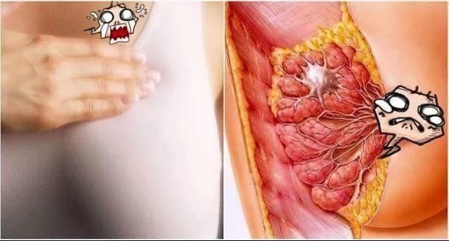 8 ผลไม้ต้านมะเร็งเต้านม กินป้องกันไว้ตั้งแต่เนิ่น ๆ ลดความเสี่ยงโรคร้ายนี้