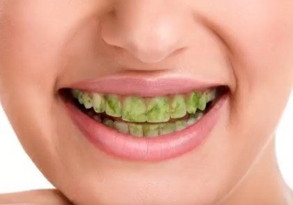 9 วิธียิ้มฟันสวยอย่างดาราฮอลลีวู้ด !?!