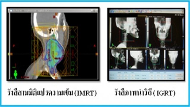 รู้จักโรค! “มะเร็งหลังโพรงจมูก” ภัยเงียบใกล้ตัวที่อาจมองข้าม