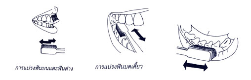 สุขภาพปากและฟันที่ดีคืออะไร
