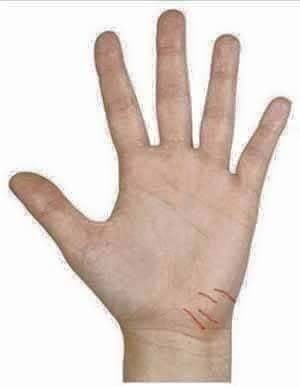 "ฝ่ามือสื่อถึงสุขภาพ" ฝ่ามือบ่งบอกถึงสุขภาพให้รู้เท่าทันก่อนสายเกินไป