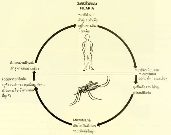 โรคเท้าช้าง ระวังไว้ให้ดี โรคติดต่อนี้มียุงเป็นพาหะ !