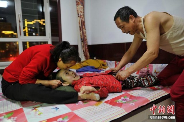 สุดซึ้ง!! พ่อแม่จีนเลี้ยงลูกสาวสมองพิการ ด้วยการเคี้ยวป้อนอาหารตลอด 15ปี