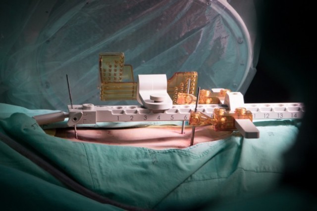 โรงพยาบาลรามาธิบดี ใช้หุ่นยนต์ช่วยผ่าตัดกระดูกสันหลังและสมอง แห่งแรกในเอเชีย