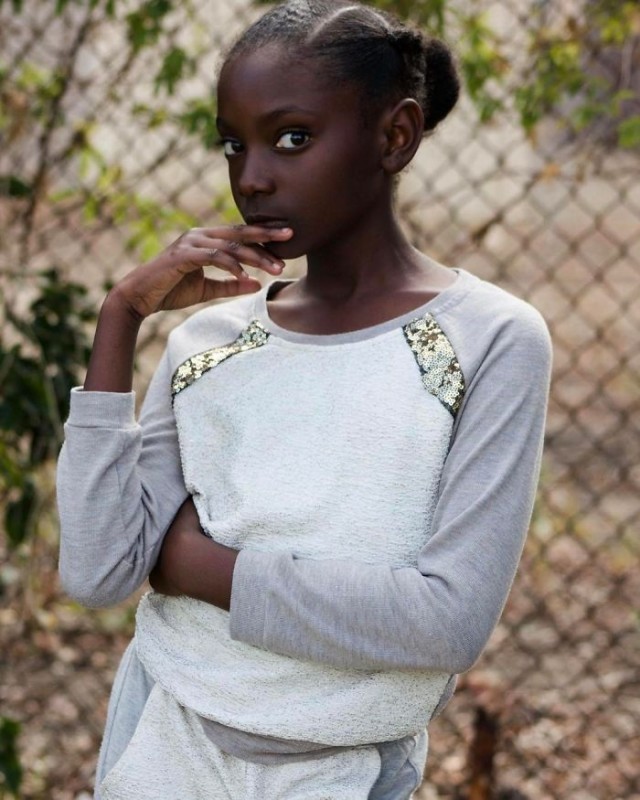 สาวน้อยวัย 10 ขวบ ถูกเพื่อนล้อเรื่องสีผิว จนเป็นนางแบบเสื้อผ้า และมีแบรนด์ของตัวเอง..!!