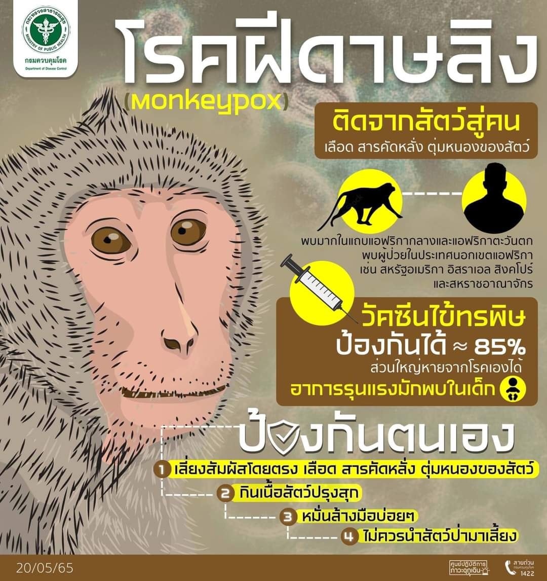 ‘ฝีดาษลิง’ (Monkeypox)