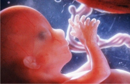 พระพุทธเจ้าตรัสแก่พระภิกษุถึงการเกิดของสัตวโลกว่า มี ๔ ประเภท