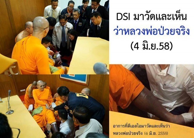 ศิษย์วัดสุดรันทด!!ภาพที่แท้จริงที่พระธัมมชโยอาพาธหนัก ซึ่งดีเอสไอเคยเห็นแล้ว 4 มิ.ย.58 ที่ผ่านมา