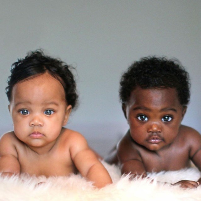 ฝาแฝดที่เกิดมาพร้อมสีผิวที่ต่างกัน ความงดงามที่แตกต่างบนโลกใบนี้