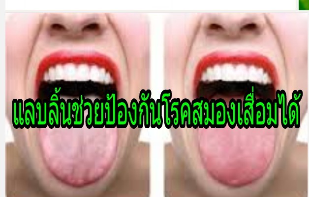 สุดทึ่ง! แค่การแลบลิ้นช่วยป้องกันโรคสมองเสื่อม