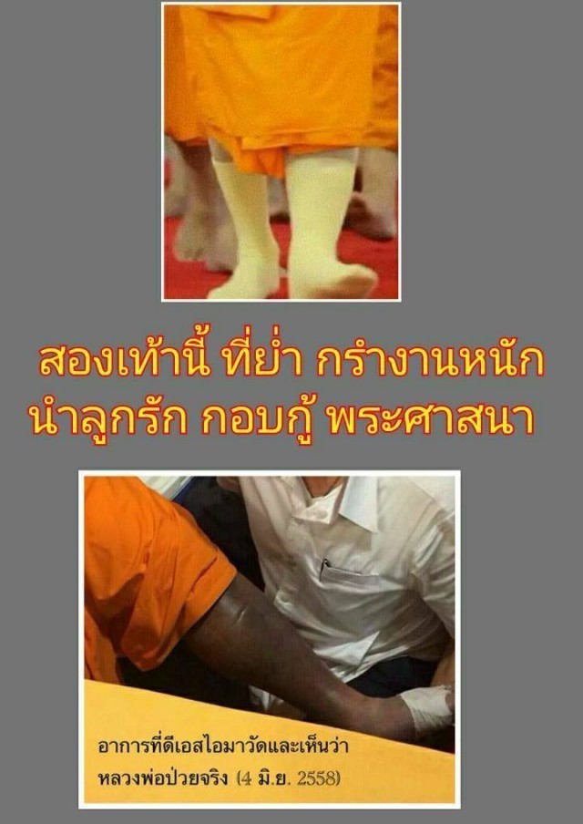 ศิษย์วัดสุดรันทด!!ภาพที่แท้จริงที่พระธัมมชโยอาพาธหนัก ซึ่งดีเอสไอเคยเห็นแล้ว 4 มิ.ย.58 ที่ผ่านมา