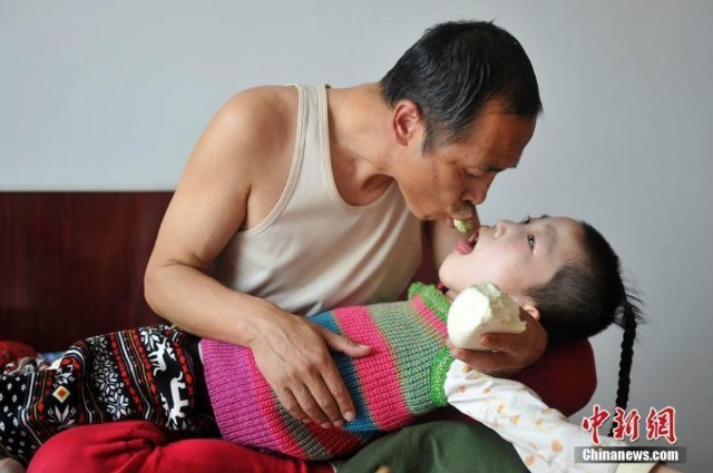 สุดซึ้ง!! พ่อแม่จีนเลี้ยงลูกสาวสมองพิการ ด้วยการเคี้ยวป้อนอาหารตลอด 15ปี