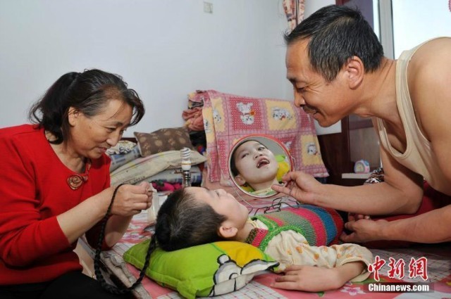 สุดซึ้ง!! พ่อแม่จีนเลี้ยงลูกสาวสมองพิการ ด้วยการเคี้ยวป้อนอาหารตลอด 15ปี