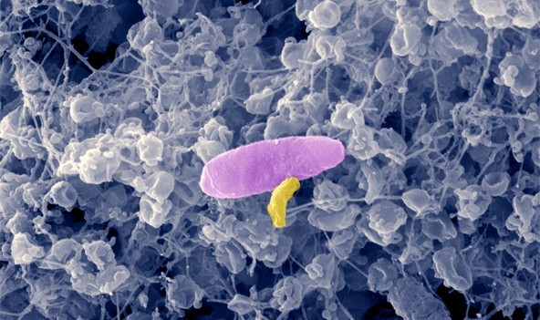 ค้นพบวิธีใหม่ใช้แบคทีเรียในการสู้กับเชื้อแบคทีเรียดื้อยา